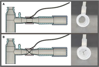 Proof-of-concept study of compartmentalized lung ventilation using system for asymmetric flow regulation (SAFR)
